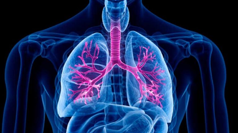 Fibrosis Quística